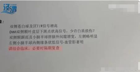 月嫂拍嗝时打盹致婴儿头顶骨骨折 真相到底是什么?
