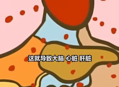 医生:患热射病时内脏像被开水煮 简直太可怕了