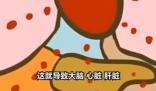 医生:患热射病时内脏像被开水煮 简直太可怕了