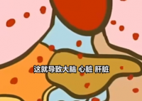 医生:患热射病时内脏像被开水煮 简直太可怕了