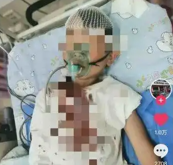 8岁男童被醉汉砸头 或需做开颅手术 真相简直太意外了