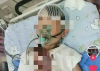 8岁男童被醉汉砸头 或需做开颅手术 真相简直太意外了
