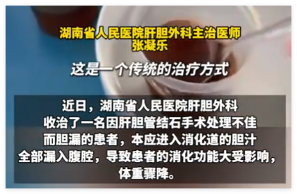 男子每天喝500ml自己的胆汁救命 事件始末2025最新消息