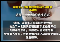男子每天喝500ml自己的胆汁救命 事件始末2025最新消息